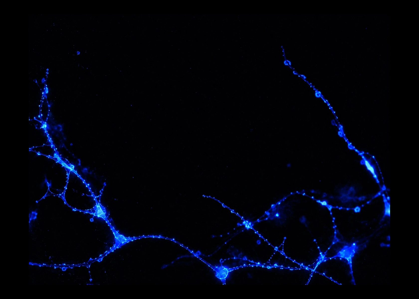 Blauw oplichtende neuronen op zwarte achtergrond als beeld voor biologie.